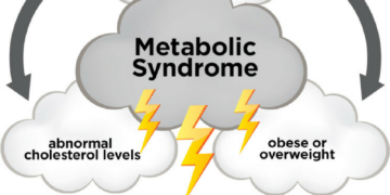 Metabolic Syndrome: Preventing the Brewing Perfect Storm