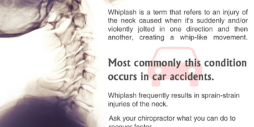 5 Facts that You Need to Know About Whiplash