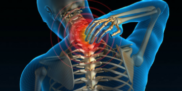 Chiropractic Provides a Long-Term Solution for Neck Pain