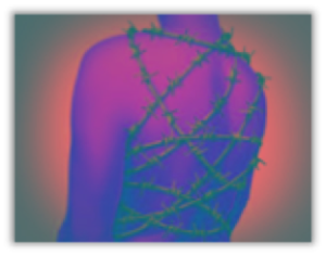 fibromyalgia