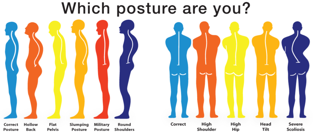 posture improvement